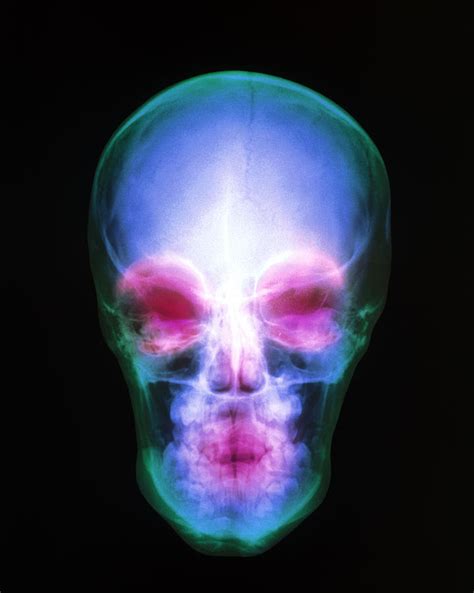 Coloured X Ray Of The Human Skull Photograph By Mehau Kulyk Pixels
