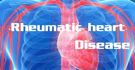 Rheumatic Heart Disease Medsynapses