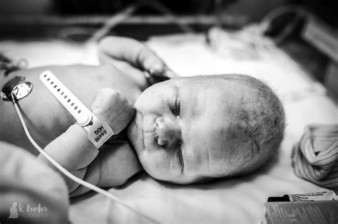 Rare Photographs Capture What Happens To A Babys Head During Birth