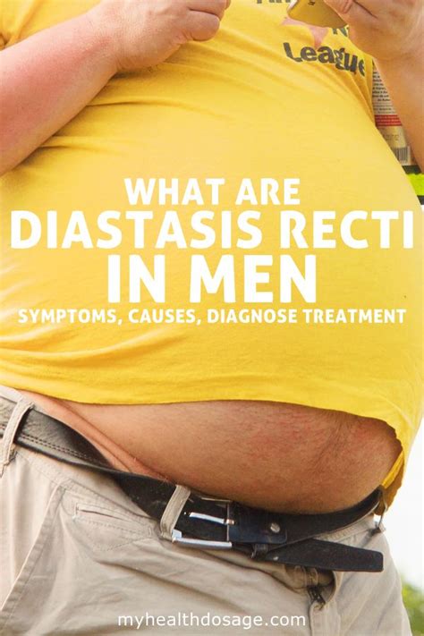 How To Identify And Fix Diastasis Recti In Men Diastasis Recti