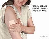 Nicotine Patch Side Effects An Iety Pictures