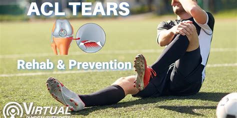 Acl Tears Causes Prevention And Treatment Virtual Physical Therapists