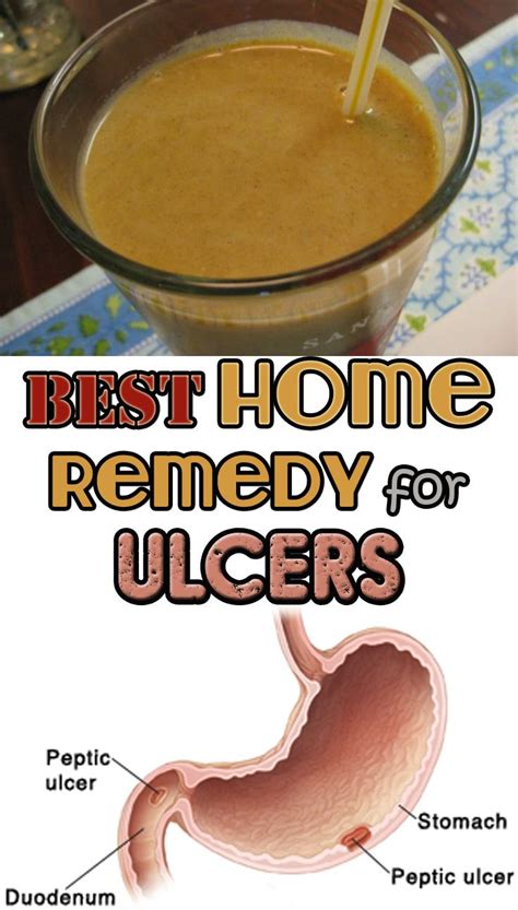 Best Home Remedy For Ulcers Remedies Apple Cider