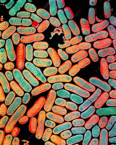 Coloured Tem Of Escherichia Coli Bacteria Stock Image B2300116