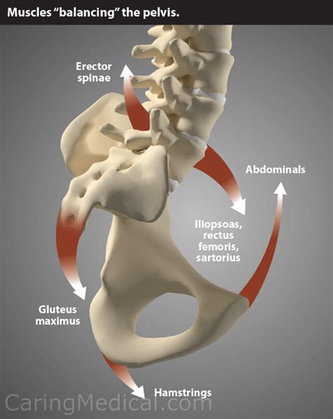 The muscles of the lower back, including the erector spinae and quadratus lumborum muscles, contract to extend and laterally bend the vertebral column. Understanding and treating pelvic incidence-lumbar lordosis mismatch - Muscle spasms and low ...