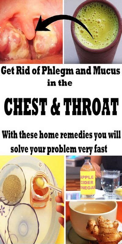 Medicine To Get Rid Of Phlegm In Throat