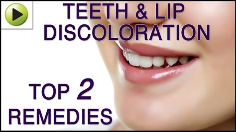Teeth And Lip Discoloration Natural Ayurvedic Home Remedies Youtube