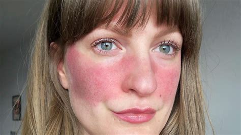 How To Er Red Spots On Face With Makeup Bios Pics