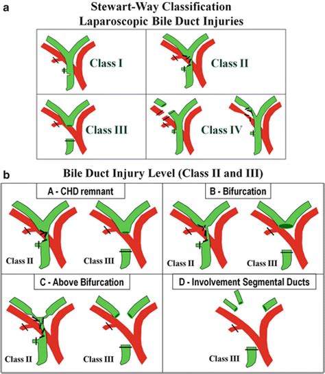 Perceptual Errors Leading To Bile Duct Injury During
