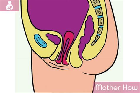 Uterine Prolapse Symptoms Causes Treatment Motherhow
