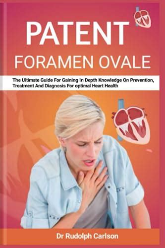 Patent Foramen Ovale The Ultimate Guide For Gaining In Depth Knowledge