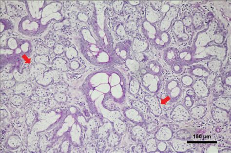 Epidermal and hair follicle tumors integumentary system. PDF Canine sebaceous adenoma of external genitalia ...