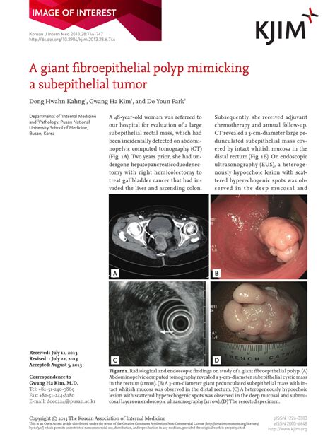 PDF A Giant Fibroepithelial Polyp Mimicking A Subepithelial Tumor