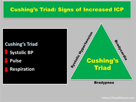 Cushing Triad In Icp And Becks Triad Health Kura Cushing Triad