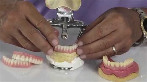 Good Fit® Instant Denture Setups Expedited Denture Systems Youtube