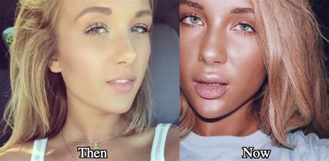 Niykee Heaton Before And After Plastic Surgery