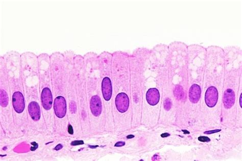 Tipos de epitelios Cómo se clasifica el tejido epitelial Curiosoando