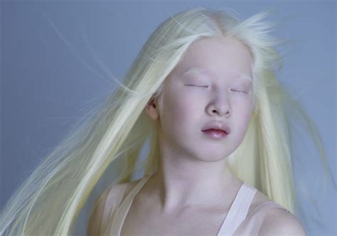 Can Albino People Dye Their Hair Detailed Guide Beauty Milly