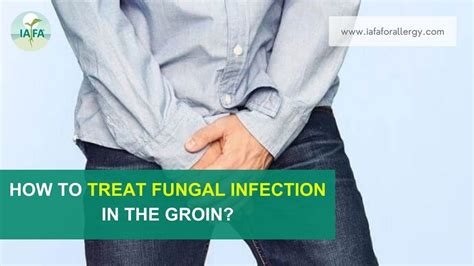 How To Treat Fungal Infection In The Groin
