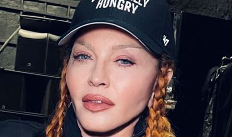 Madonna Shows Off Surgery Results Now Swelling Has Gone Down In Dig