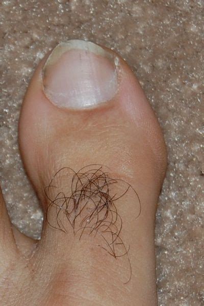 Hairy Toes Women With Mustaches Gross Feet Stinky Feet