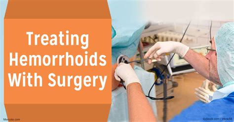Treating Hemorrhoids With Surgery