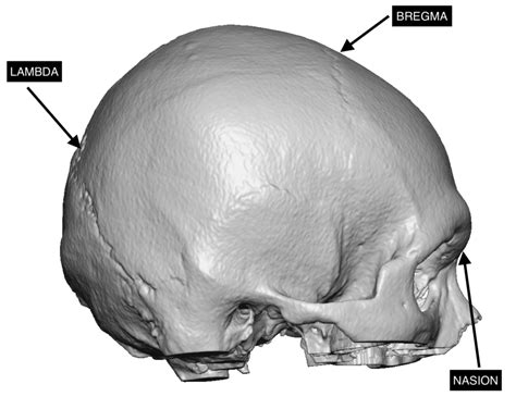 Skull Profile Landmarks Dr Barry Eppley Indianapolis Explore Plastic