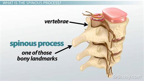 Spinous Process: Function & Fracture Treatment - Video ...