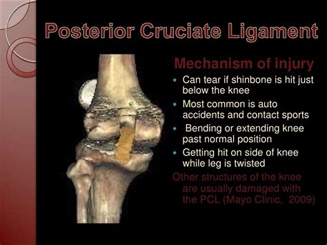 Injuries To Acl Pcl And Mcl