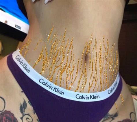 Love Your Body Women Sharing Photos Of Stretch Marks On Instagram To