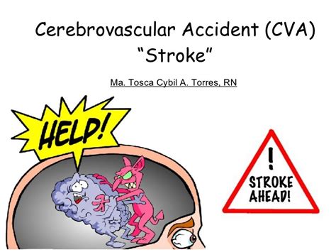 Cerebrovascular Accident Cva