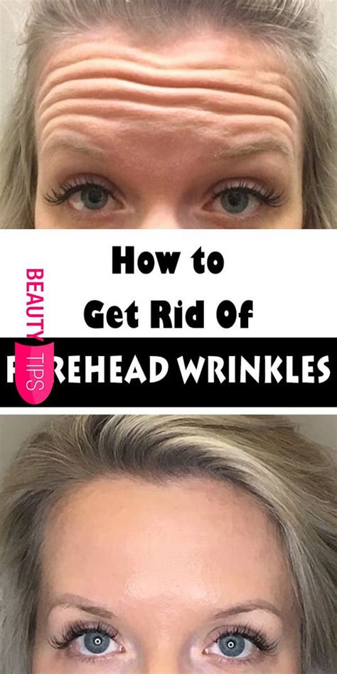 Best Wrinkle Cream For Forehead Lines
