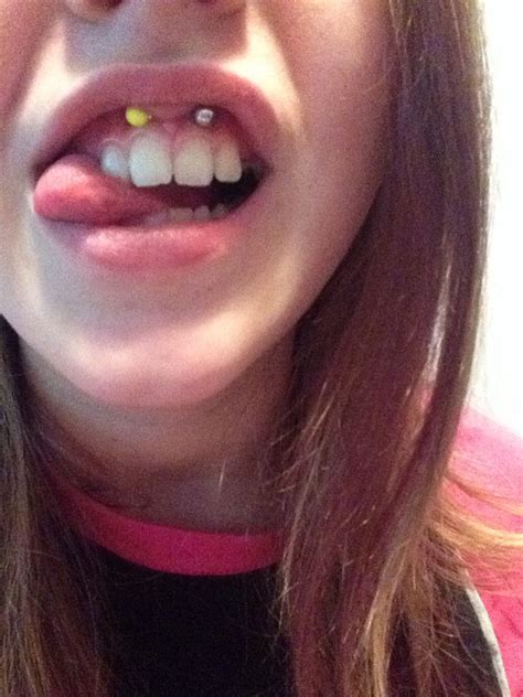 Infected Smiley Piercing Pictures Best Piercing Ideas
