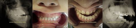 ¿qué Hacemos Clínica De Especialidad Odontológica Del Dr Raúl Bueno