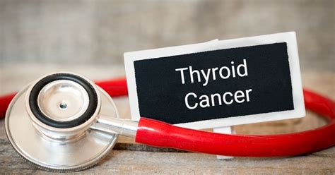 Understanding Thyroid Cancer Symptoms Facty Health