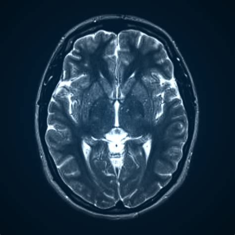 Brain Image Mri