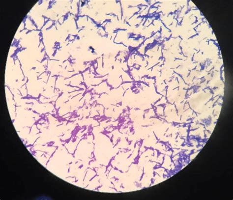 Gram Staining Under Microscope