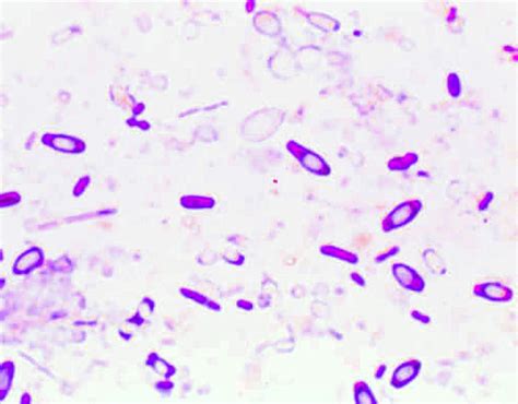 Clostridium Endospores Direct Stain In Dogs Canis Vetlexicon