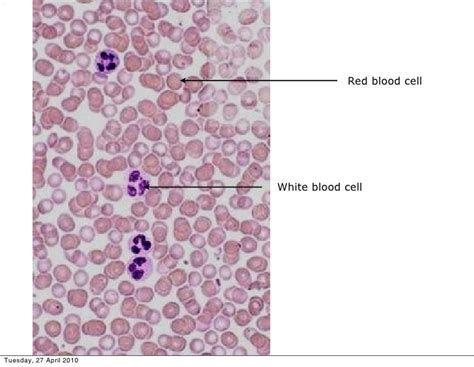 White Blood Cells Under Microscope Labeled Micropedia