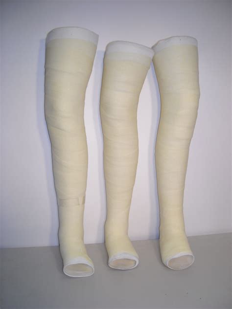Plaster Cast Leg