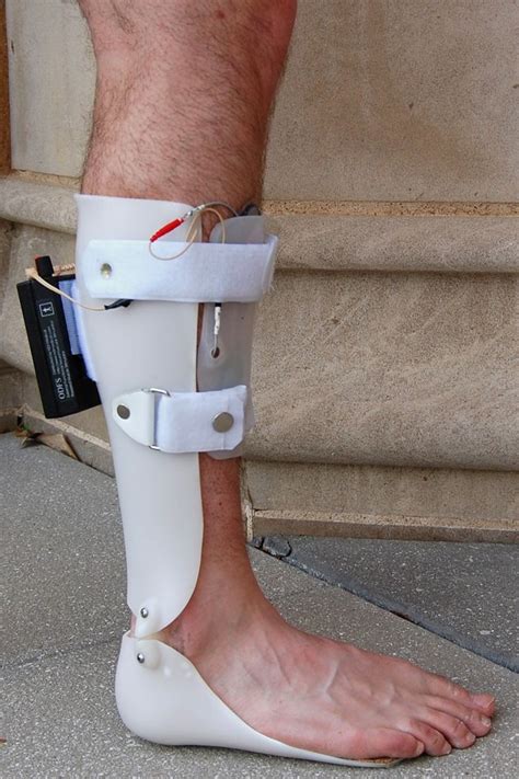 Pin By Michael Brennan On Charcot Ankle Foot Orthosis Orthotics And