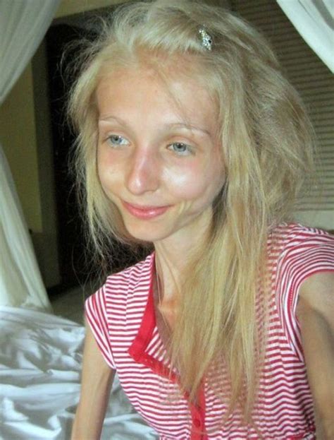 Post News 20 Year Old Russian Girl Ksenia Bubenko On Extreme Super Diet 16 Photos