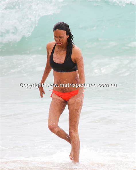 Turia Pitt Sighted In Bikini Showing Off Post Baby Weight Matrixpictures Au
