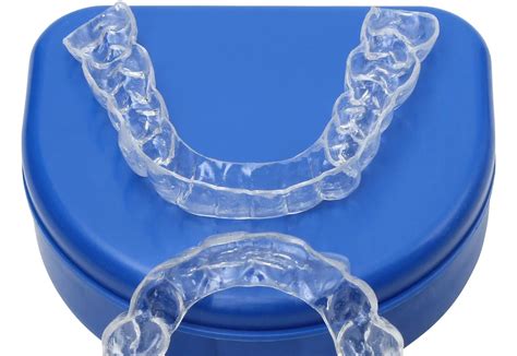 15 How To Clean Clear Retainers After Braces Ideas Inspireado