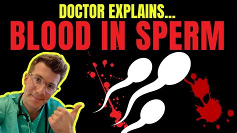 Doctor Explains Causes And Treatment Of Hematospermia Aka Blood In The Sperm Or Semen Youtube
