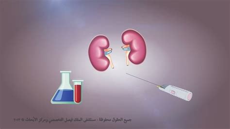 Kidney Renal Biopsy By Ihsan Yagmor 3243ihsan Tasmeem Me