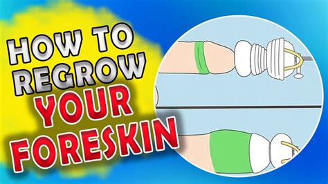 Foreskin Restoration How To Regrow Your Foreskin Youtube