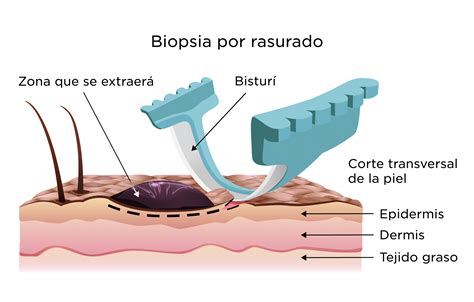 biopsia de piel my doctor online