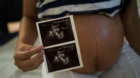Growing Support Among Experts For Zika Advice To Delay Pregnancy The