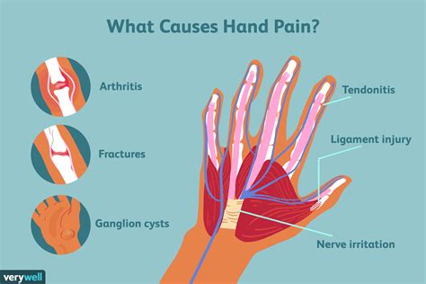 Hand Pain Causes And Treatments